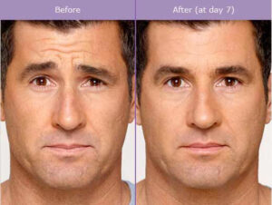 globaleliteesthetician